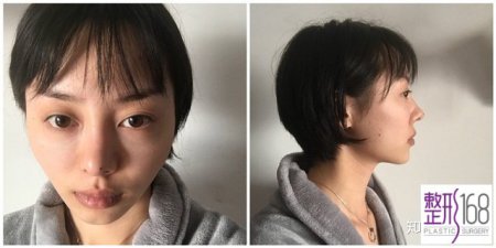 ȧ255쾭