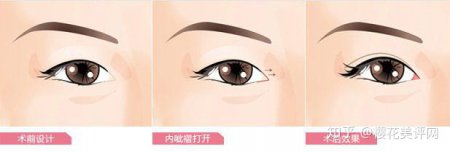 ۽ǰ̺ô죿
