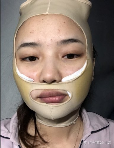 ȧ±仯ҽԺҽ