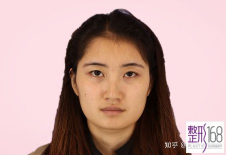 ݵ沿֬Ч