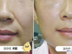 ䷨ƶǮ